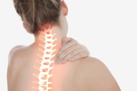 Gimdos kaklelio osteochondrozė